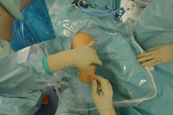 Chirurgia - Ricostruzione LCA Video VR